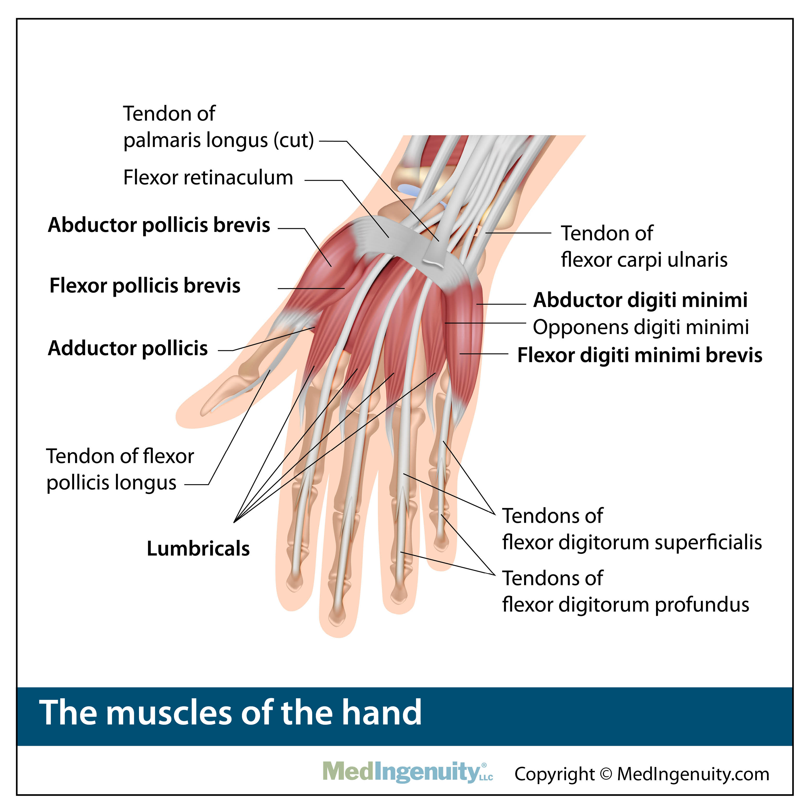 Orthopedic Anatomy Library - Northwest Hills Surgical Hospital in
